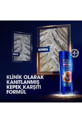 Men Kepeğe Karşı Etkili Şampuan Saç Dökülmesine Karşı 350 ml X3 - 4
